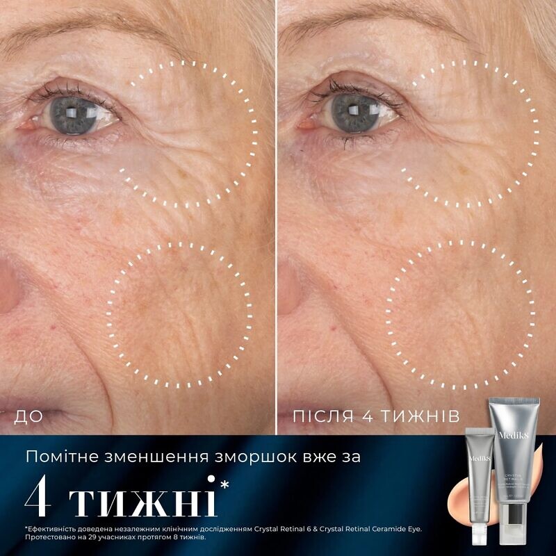 Medik8 Retinal Rewind - Набір для омолодження шкіри обличчя та зони навколо очей - Зображення 5