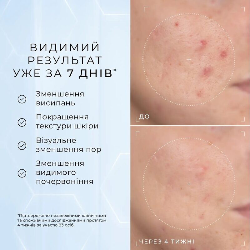 Medik8 Niacinamide Peptides 30 мл – Пептидна сироватка з 10% ніацинаміду для зменшення висипань та візуального звуження пор - Зображення 4