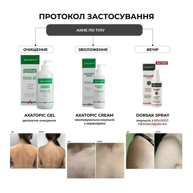 Braderm Dorsak Spray 100 мл – Активний протизапальний спрей з Бензоїл пероксидом 6% - Зображення 2