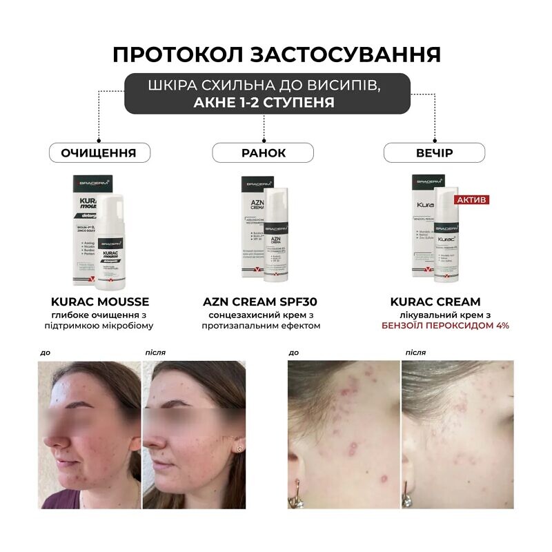 Braderm Kurac Cream 30 мл – Активний протизапальний крем з бензоїл пероксидом 4% - Зображення 5