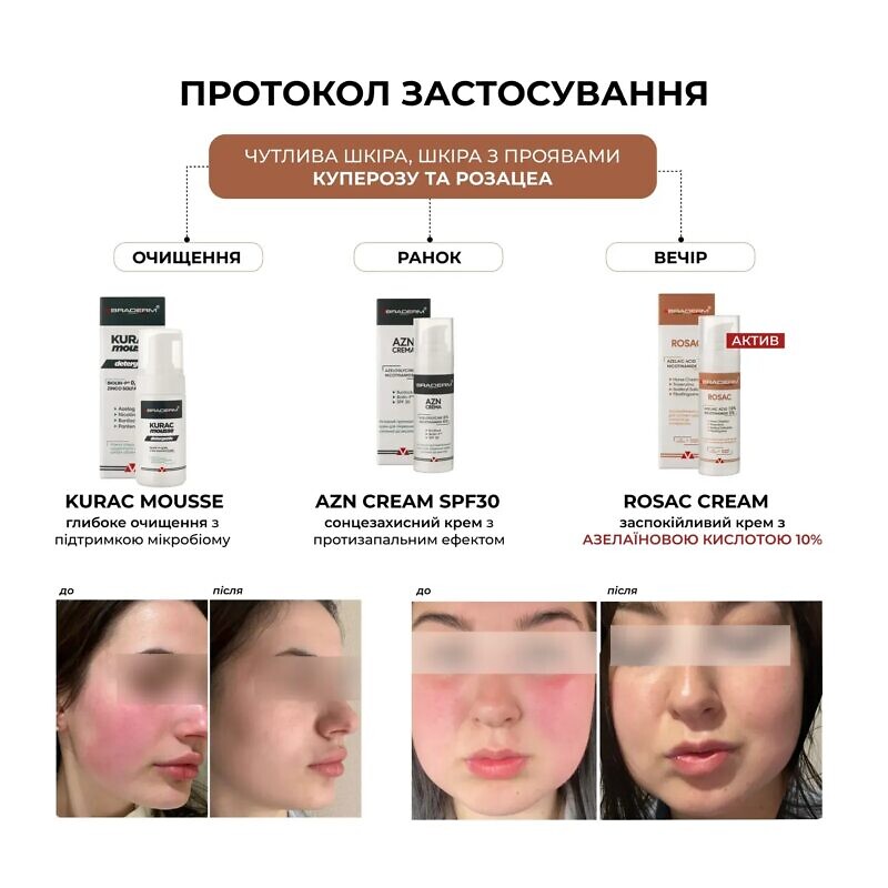 Braderm Rosac Cream 30 мл – Заспокійливий крем для чутливої шкіри - Зображення 2